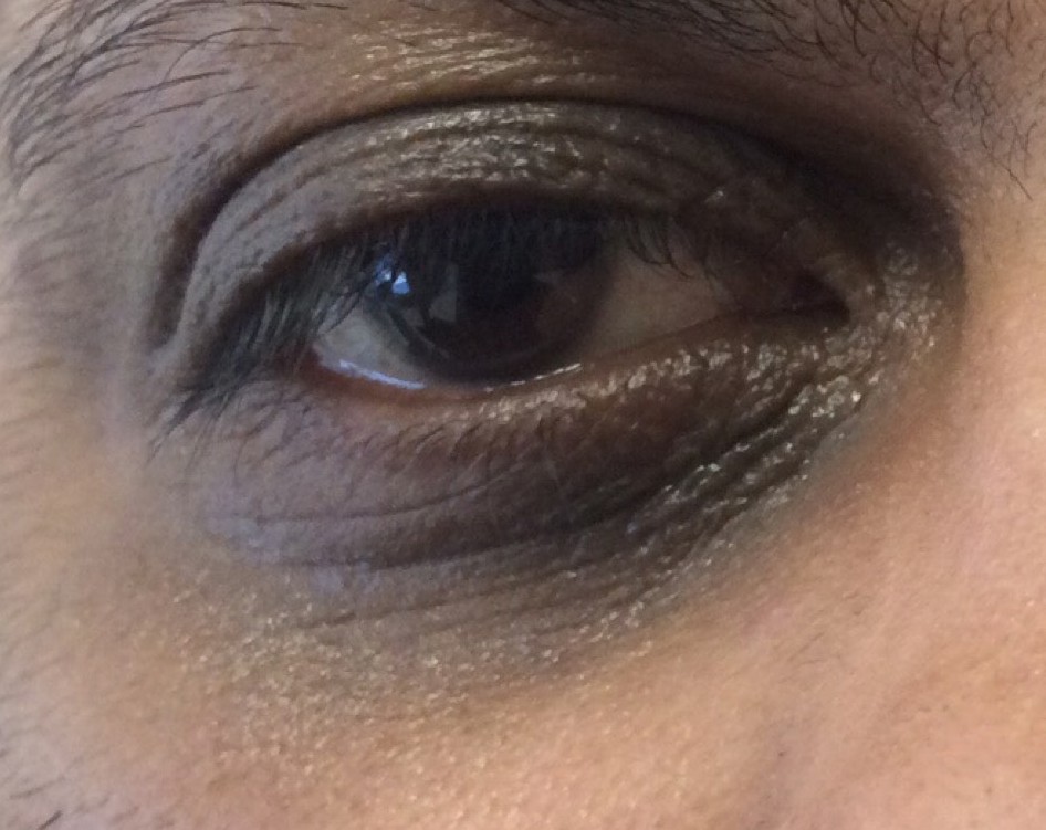 PM Anti-Aging Eye Cream — Baseline