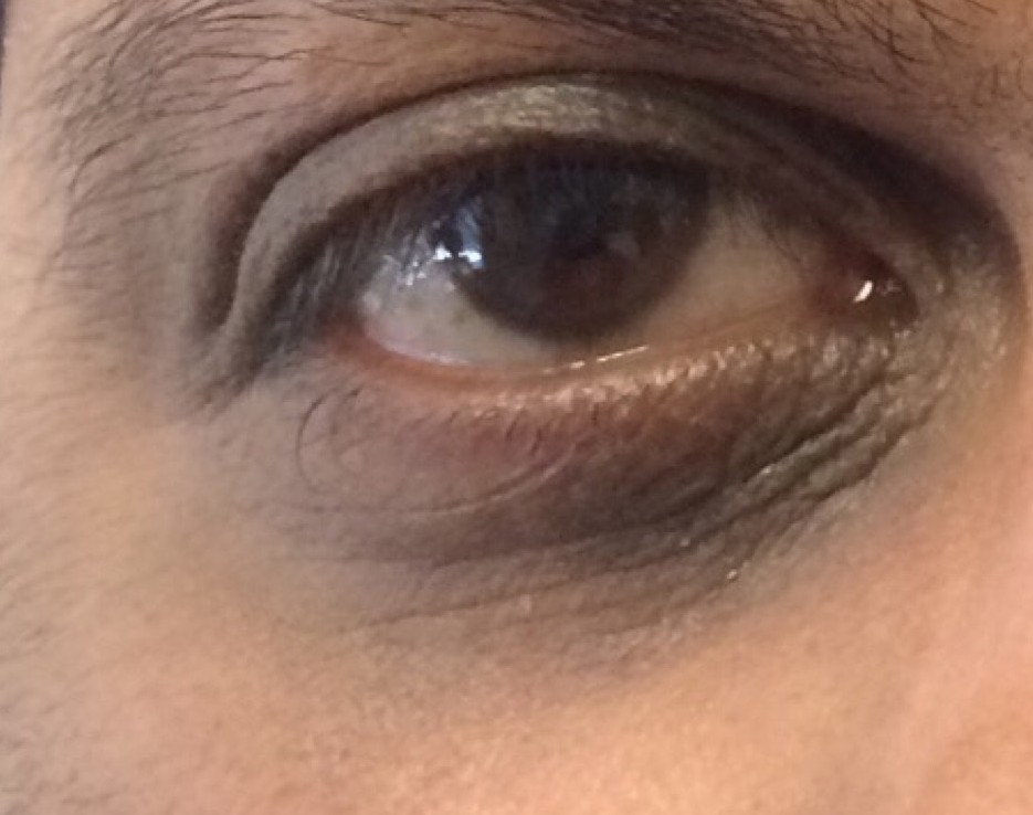 PM Anti-Aging Eye Cream — Week 12