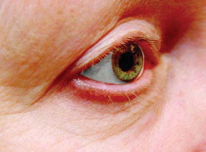 PM Anti-Aging Eye Cream — Baseline